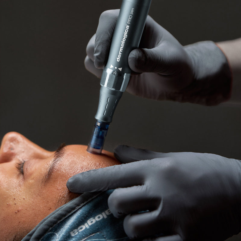 Microneedling